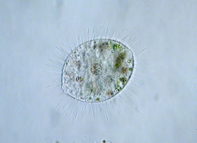 Stefansbachtal Gevelsberg Leben im Teich Einzeller (Protista